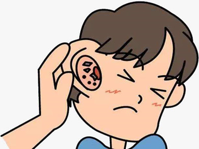   耳朵痒痒，要及时预防耳道病变